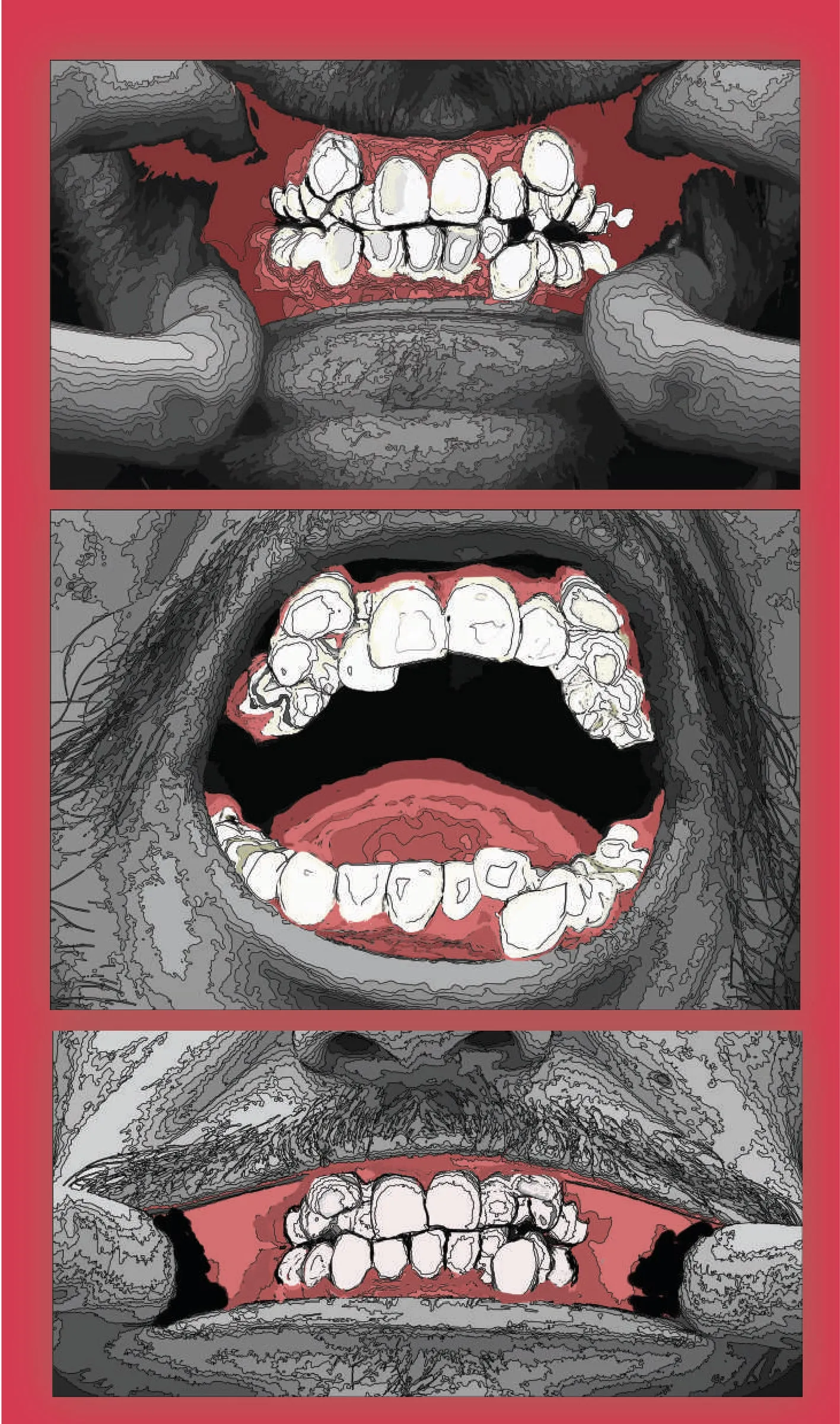Three stacked black-and-white close-ups of open mouths with crooked teeth, tinted red, in a red frame